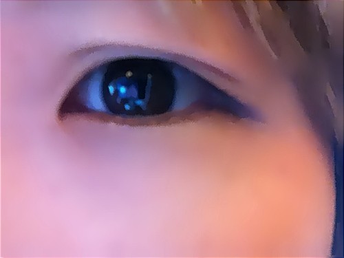 CL 雙眼皮